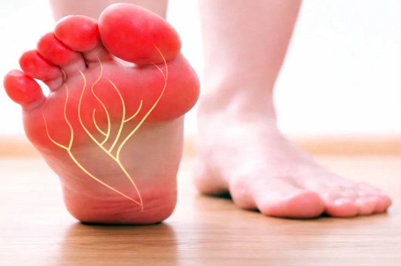 آیا علت داغ شدن کف پا چربی خون است؟